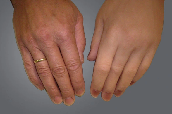 Richter Orthopädie-Technik – Bild 3