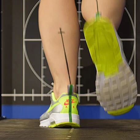 Vierbaum Orthopädie GmbH – Bild 2