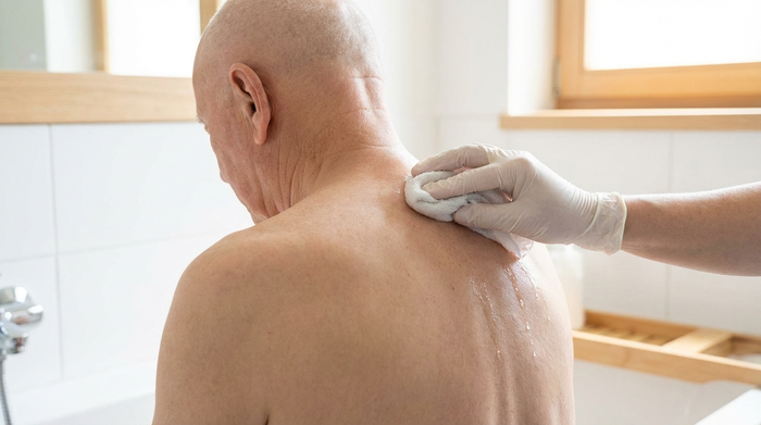 Nahaufnahme des Rückens eines älteren Mannes in einem hellen Badezimmer. Eine pflegende Hand reinigt sanft die intakte, unbehaarte Hautpartie am oberen Rücken mit einem weichen Waschlappen und klarem Wasser. Die Szene wirkt hygienisch, ruhig und professionell.