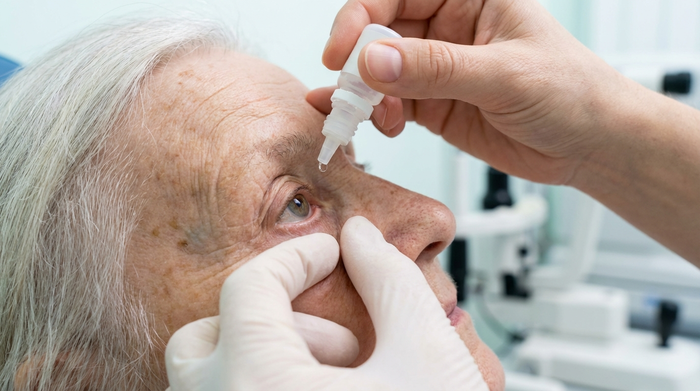 Nahaufnahme: Eine pflegende Hand zieht sanft das Unterlid eines älteren Menschen nach unten, um eine kleine Tasche zu formen. Die andere Hand hält ein kleines Fläschchen senkrecht über das Auge, ohne es zu berühren. Ruhige, klinisch saubere Umgebung.